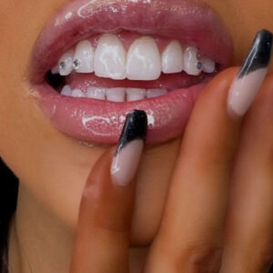 Brillantino Dente