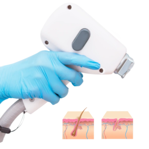 Epilazione Laser Vimodrone